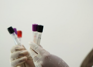 manos sosteniendo muestras de pcr de coronavirus covid19 examenes